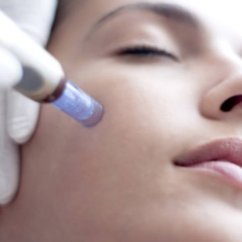 Mésothérapie et Microneedling