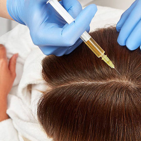 Plasma riche en plaquettes (PRP)